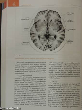 A pszichiátria magyar kézikönyve