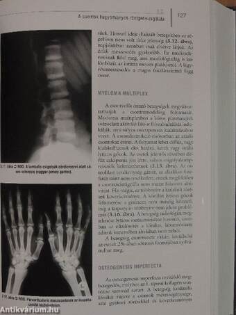 A csontanyagcsere betegségei