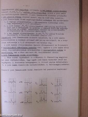 EKG alapismeretek