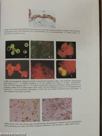 Investigation of interleukin-10 receptor expression in human placenta, isolated cytotrophoblast cells and human keratinocytes