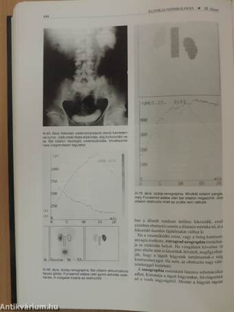 Nephrologia