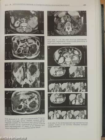 Nephrologia