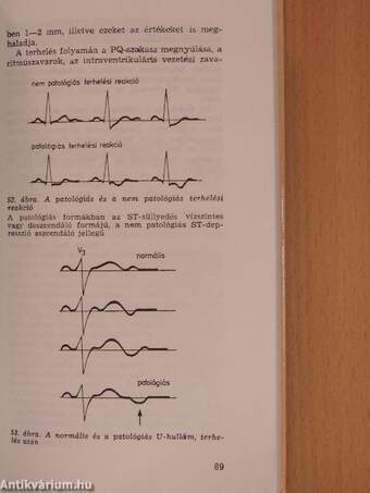 Gyakorlati elektrokardiográfia