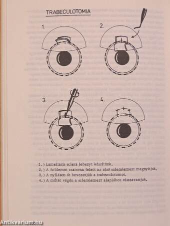 Újabb eredmények a szemészetben 1975/2.