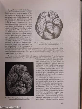 Neurologia