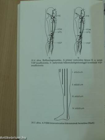 Angiológiai Doppler-diagnosztika