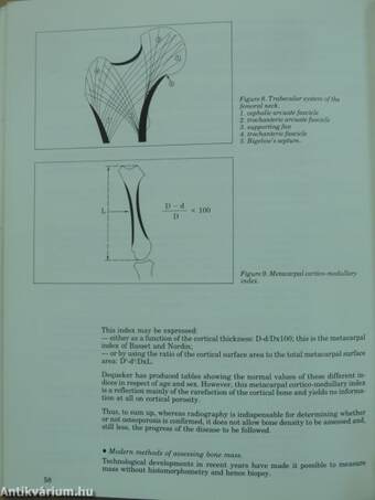 Menopause and Osteoporosis