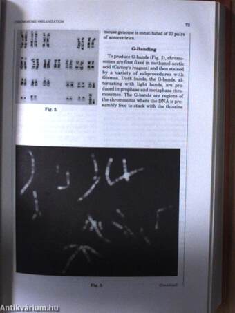 Chromosomes - A synthesis