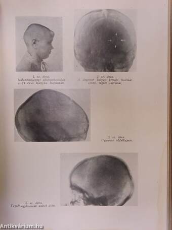 Emlékkönyv verebélyi Verebély Tibor tanári működésének 25. évfordulójára 1914-1939