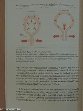 Mit kell ma tudni az inkontinenciáról?