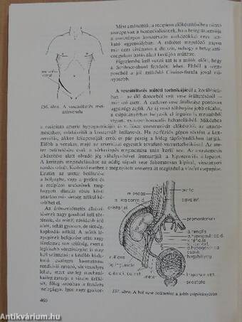 Nephrologia