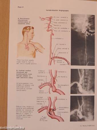 Clinical Symposia 4/1974