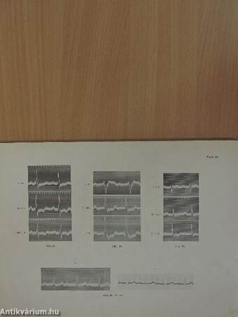 Atlas der klinischen Elektrokardiographie