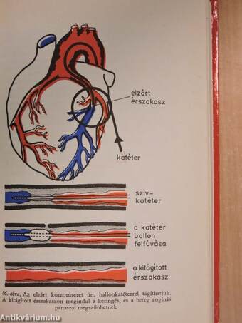 Szív- és érbetegségekről mindenkinek