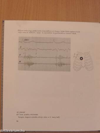 Hallgatódzás a szív felett I. (töredék) - 3 db hanglemezzel