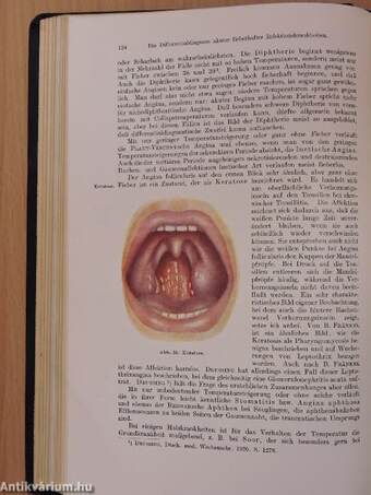 Lehrbuch der Differentialdiagnose innerer Krankheiten