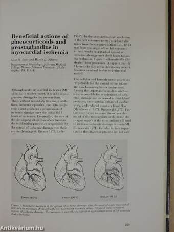 Acute and Long-Term Medical Management of Myocardial Ischaemia