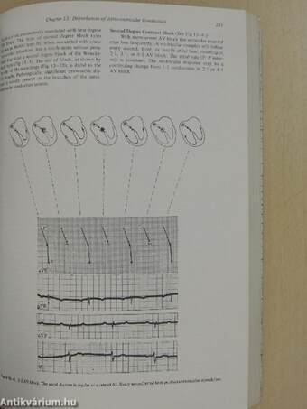 Principles of Clinical Electrocardiography