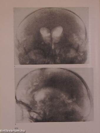 A klinikai neurologia alapjai