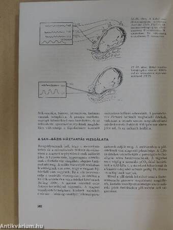 Az újszülött 1. (töredék)