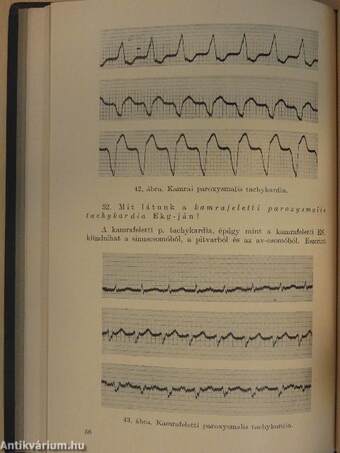 Elektrokardiographia a mindennapos orvosi gyakorlatban