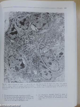 Greenfield's Neuropathology I-II.