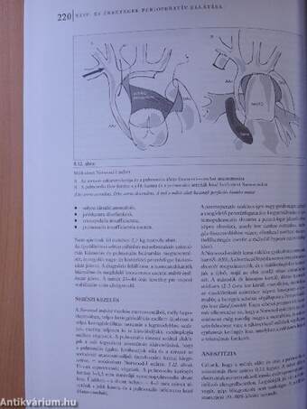 Szív- és érbetegségek perioperatív ellátása