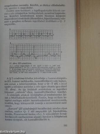 A ritmuszavarok diagnózisa és terápiája