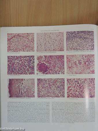 Colour Atlas of Histopathology