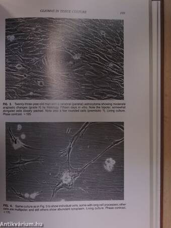 Progress in Neuropathology 6.