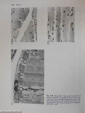 Greenfield's Neuropathology