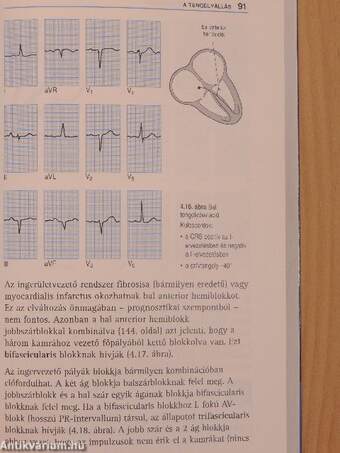 Az EKG helyes értelmezése