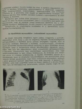 Szív- és vérkeringési betegségek csecsemő- és gyermekkorban