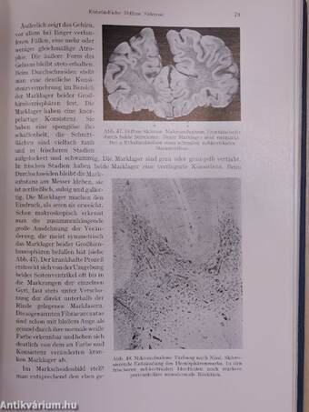 Spezielle Pathologie der Krankheiten des Zentralen und Peripheren Nervensystems