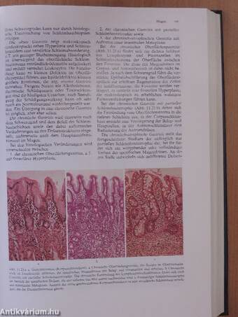 Lehrbuch der Allgemeinen Pathologie und der Pathologischen Anatomie