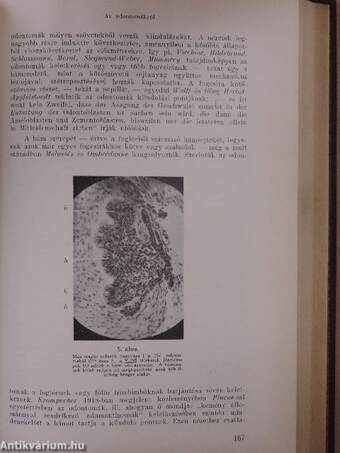 A budapesti kir. magyar Pázmány Péter Tudományegyetem stomatologiai klinikájának emlékkönyve 1908-1933/Dolgozatok a Budapesti Kir. Magy. Pázmány Péter Tudományegyetem stomatologiai klinikájáról