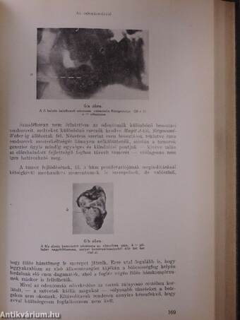 A budapesti kir. magyar Pázmány Péter Tudományegyetem stomatologiai klinikájának emlékkönyve 1908-1933/Dolgozatok a Budapesti Kir. Magy. Pázmány Péter Tudományegyetem stomatologiai klinikájáról