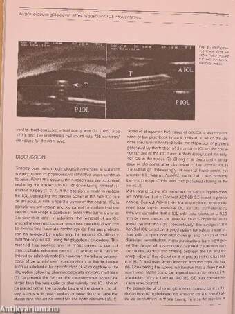 European Journal of Ophthalmology September-October 2008