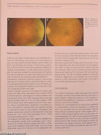 European Journal of Ophthalmology September-October 2008