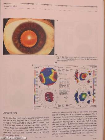 European Journal of Ophthalmology September-October 2008