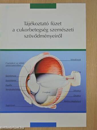 Tájékoztató füzet a cukorbetegség szemészeti szövődményeiről