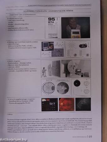 Neuro-ophthalmologia