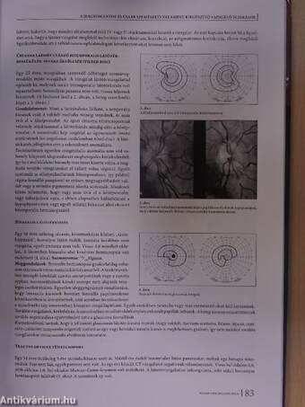 Neuro-ophthalmologia