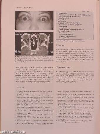 Neuroophthalmologia