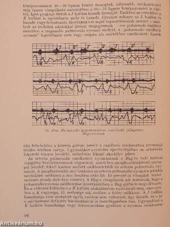 A keringés ballistokardiographiás vizsgálata