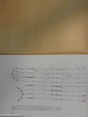 Spehlmann's EEG Primer