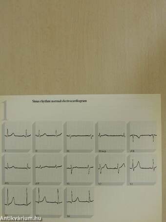 Electrocardiography