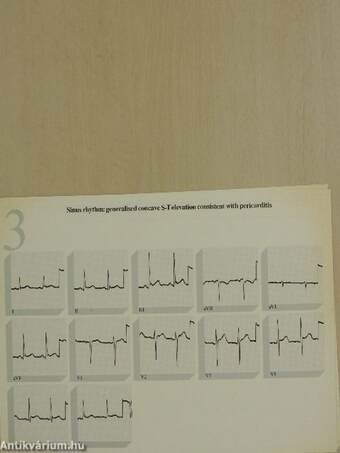 Electrocardiography