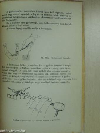 A mindennapi gyakorlati foghúzás és érzéstelenités