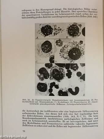 Klinik und Pathologische Anatomie der Erythromyelosis Leukaemica